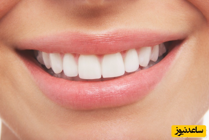 تفاوت بلیچینگ و جرمگیری دندان چیست؟