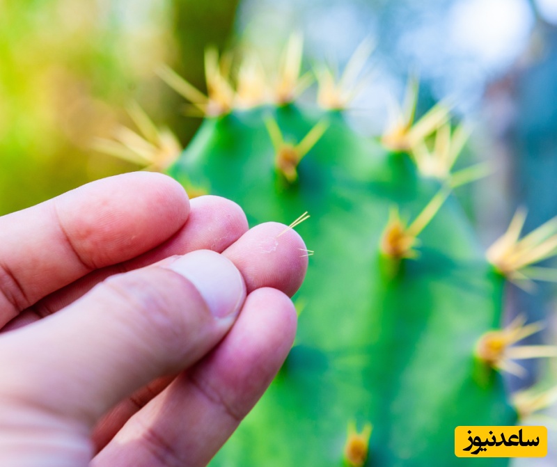 چگونه خارهای ریز کاکتوس را بدون درد و عفونت از پوست جدا کنیم؟