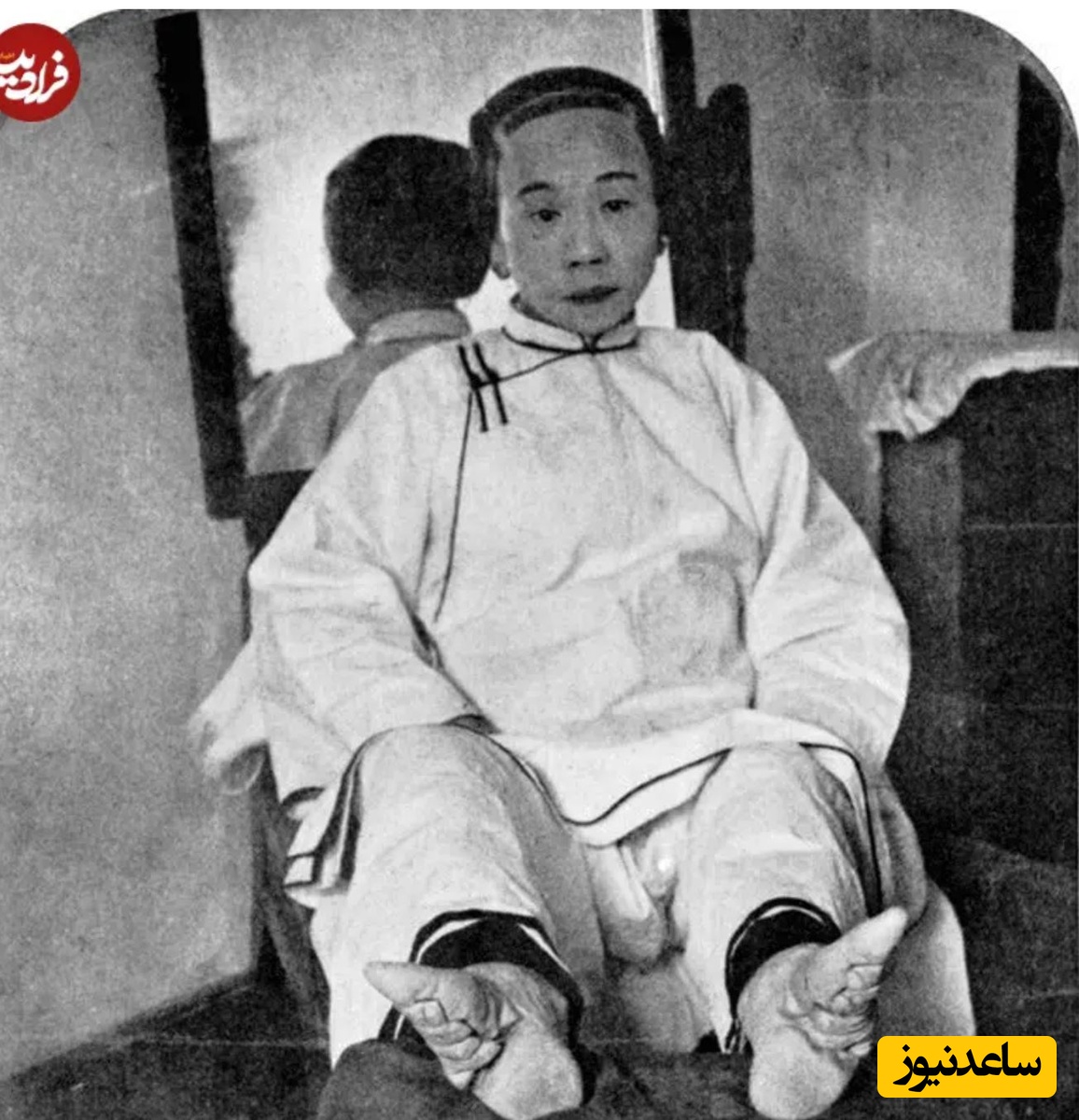 عکس مربوط به حدود یک قرن قبل که دختری از طبقه بالای اجتماع را با پاهای بسته شده و تغییر شکل یافته نشان می‌دهد