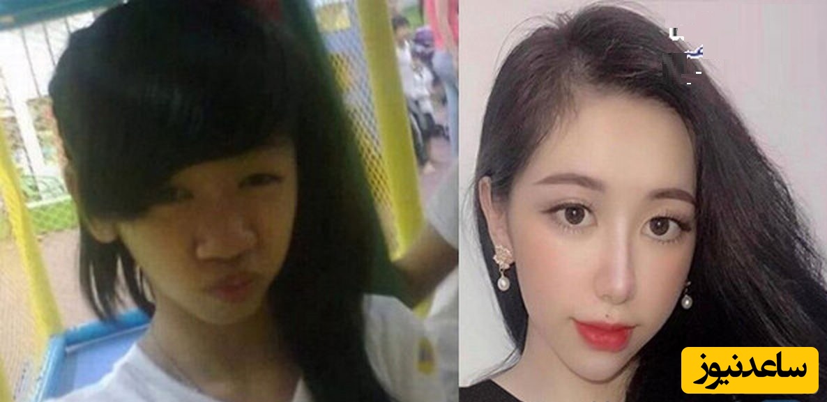 داستان عجیب دختری که پس از جدایی از نامزدش چهره اش را تغییر داد