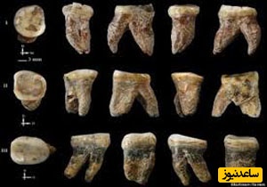 کشف دندان‌هایی با «نگین یشم» که متعلق به یک کودک هفت ساله بوده‌اند