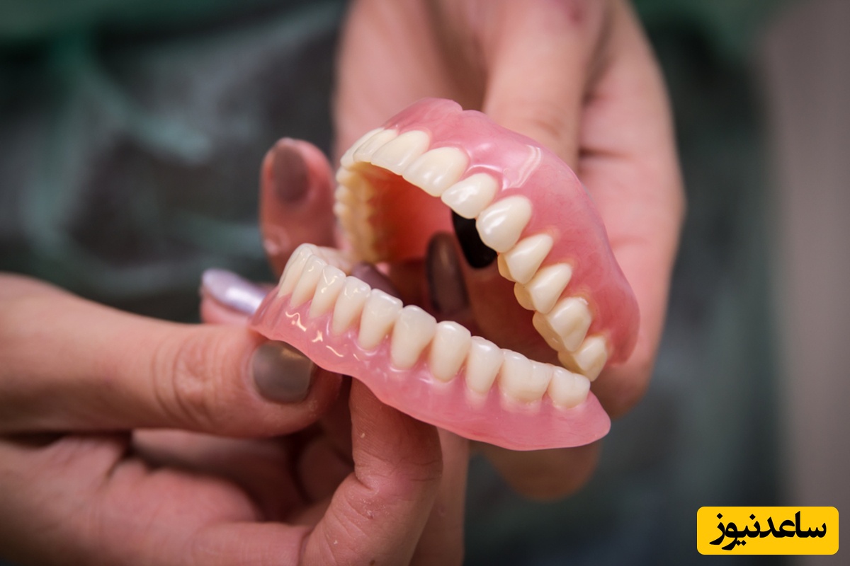 مزایا و معایب دندان مصنوعی فوری
