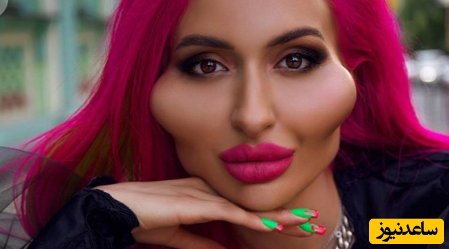 باربی بلغار و رکوردار بزرگ‌ترین لب‌های دنیا هنوز هم می‌خواهد به تزریق فیلر ادامه دهد