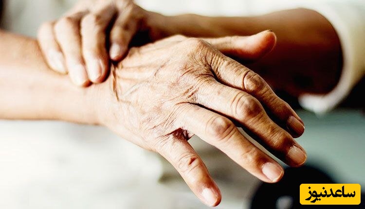 علائم کمبود ویتامین D در بدن افراد