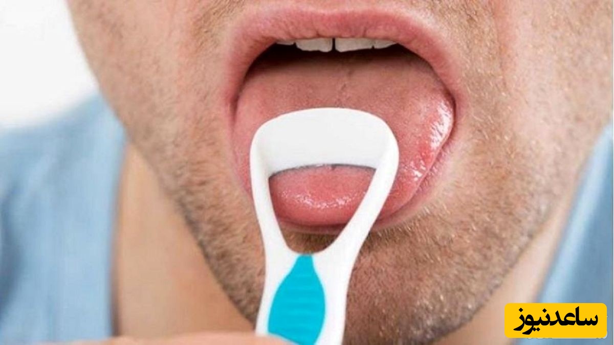 زبان‌کوچک چیست؟