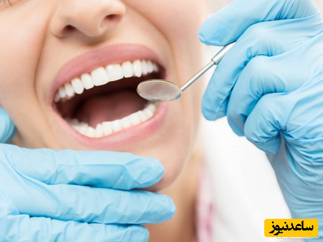 دندان خرگوشی چیست؟