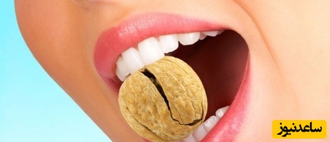 ترک مویی دندان چیست و علل آن