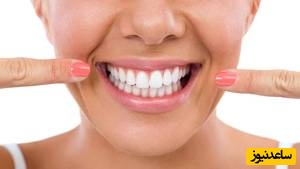 آیا ناهماهنگی خط وسط دندان نیاز به درمان دارد؟