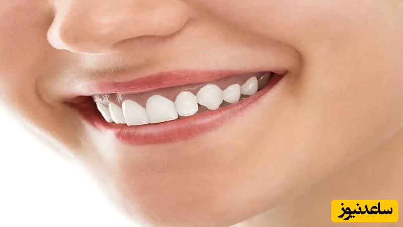 دلیل تیرگی لثه‌ها چیست؟  و روش های درمان آن