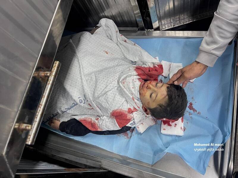 حملات خونین رژیم صهیونیستی به نوار غزه