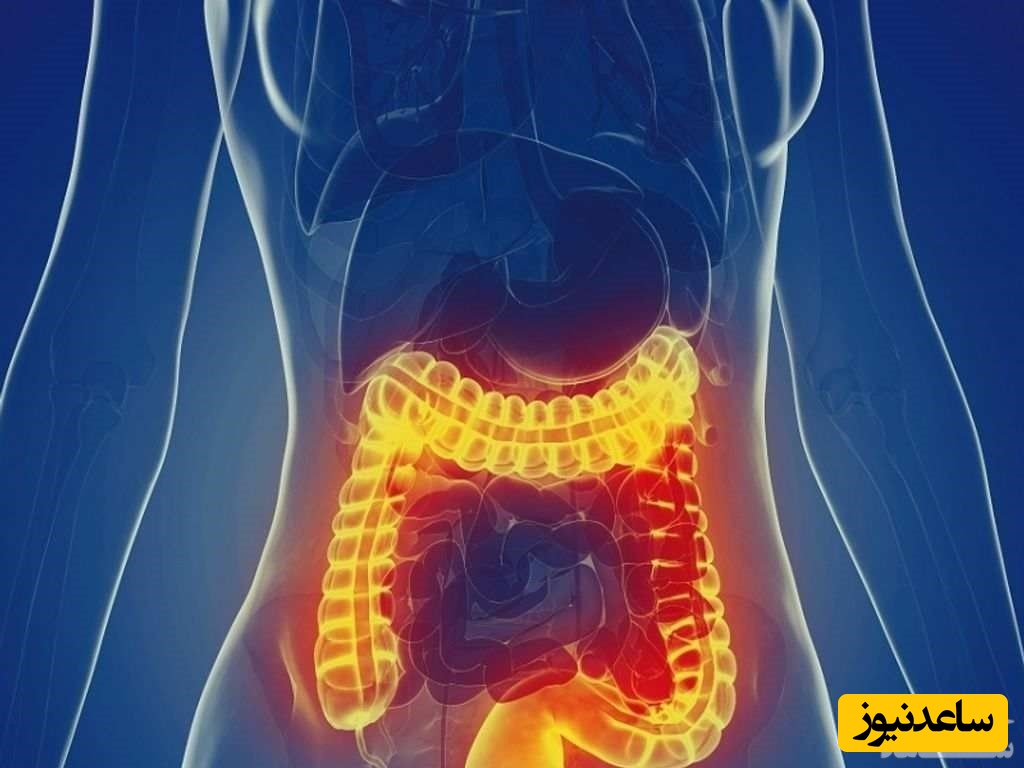 رابطه جنسی در افراد مبتلا به سندرم روده تحریک‌پذیر
