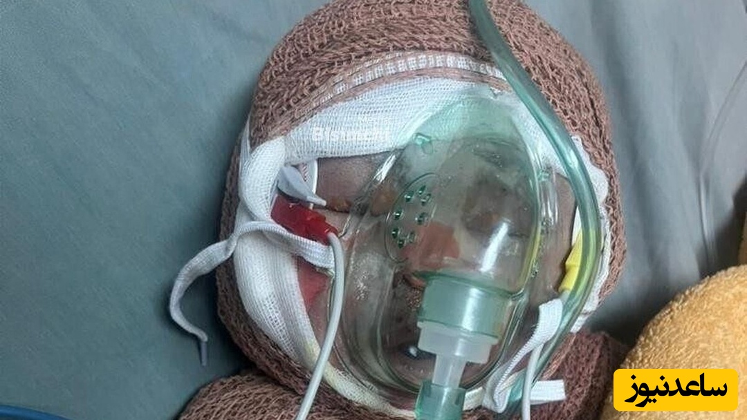 آخرین جمله‌‌ی مادر رایان قاسمی وقتی با هشتاد درصد سوختگی، سوار آمبولانس می‌شد! +ویدیو