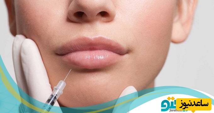 نکات مراقبتی مهم بعد از تزریق ژل [سال 2023] ✔️