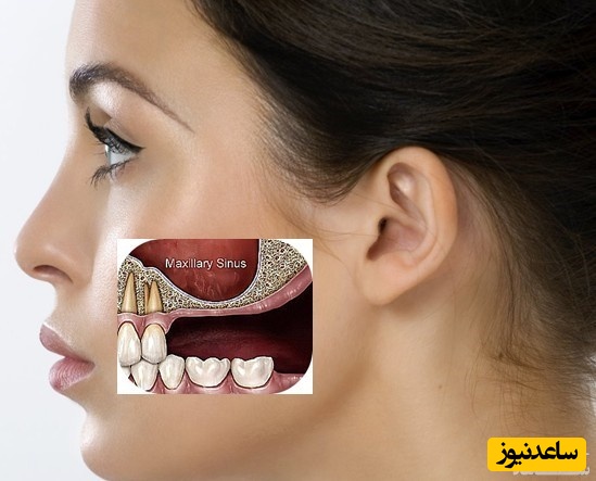 5 راه درمان خانگی عفونت دندان