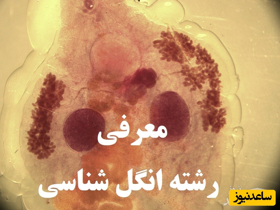 آشنایی با رشته انگل شناسی پزشکی و بازار کار آن