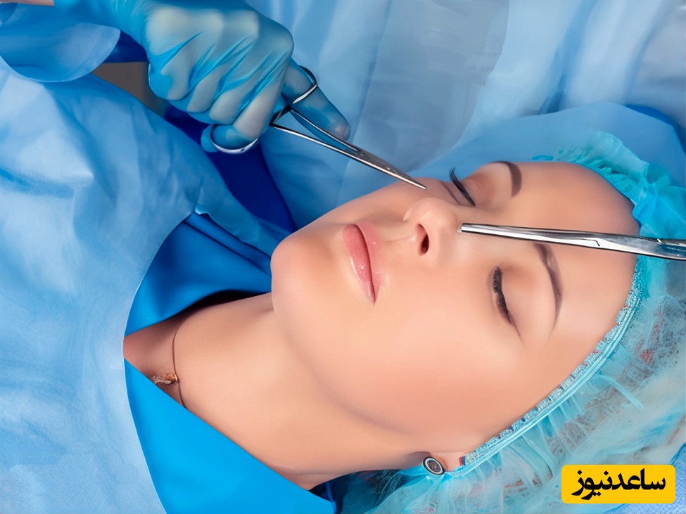 بهترین دکتر جراح بینی در تهران کیست؟ معرفی  و نمونه کارهای دکتر حامد عباسی