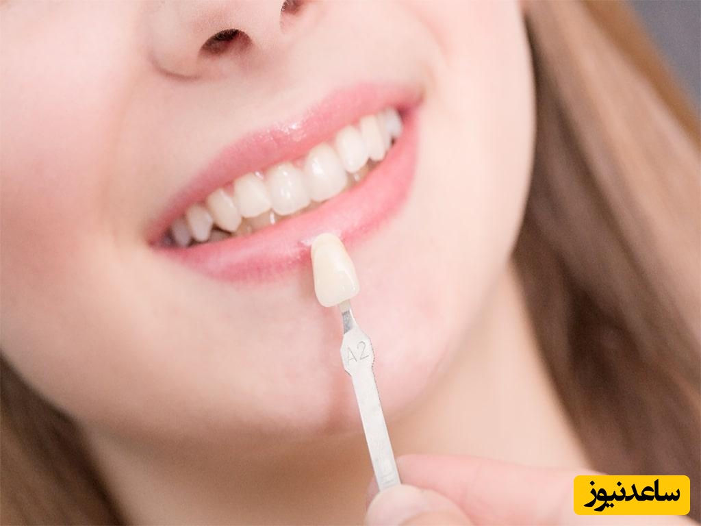 انواع دندان و عملکرد آنها چیست؟
