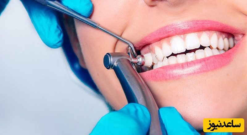 اصلا چرا باید جرم گیری کنیم؟