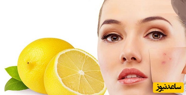 بهترین ماسک های خانگی لیمو ترش برای پاک سازی پوست