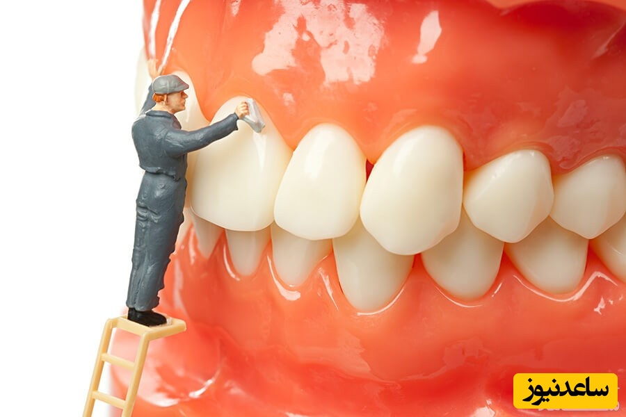 جوش شیرین برای جرم گیری دندان چه کاربردی دارد؟