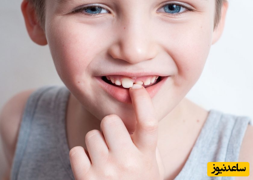آیا لق شدن دندان دائمی امکان پذیر است؟