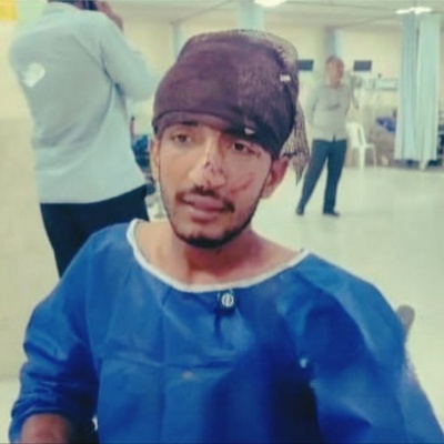 فوری: اولین تصاویر از ماهیگیر مجروح شده در اثر حمله پهپادی در خلیج فارس + روایت لحظه برخورد پهپاد به قایق ماهیگیری