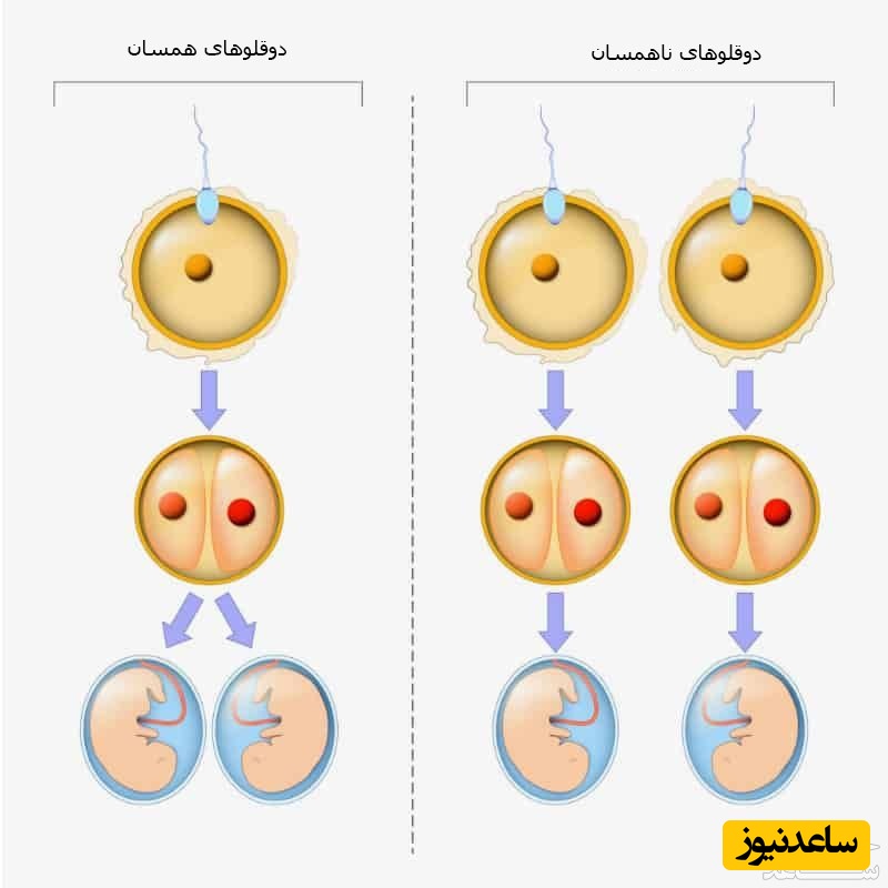 مقایسه دوقلوها