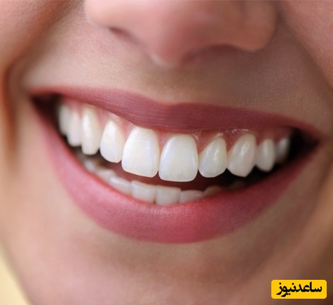 راز سفیدی دندان های هنر پیشه ها و خواننده ها چیست؟