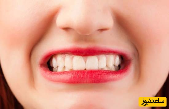 دندان قروچه