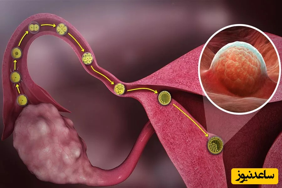 قطع نشدن خونریزی و طولانی شدن پریود چه دلایلی دارد؟