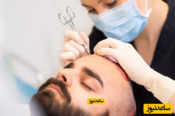 چه کسانی می‌توانند مدرک کاشت مو بگیرند؟