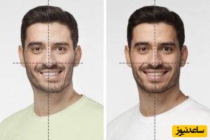 پیشگیری از انحراف فک