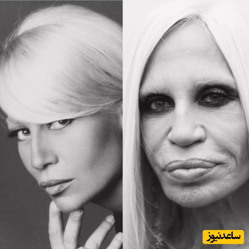 ۸ زن مشهور هالیوود که از عمل های زیبایی خود ابراز پشیمانی کردند