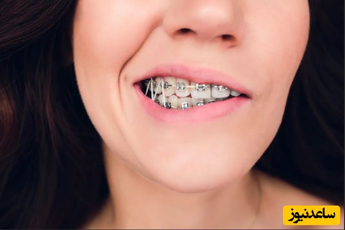 متخصص ارتودنسی چه مشکلاتی را حل می‌کند؟