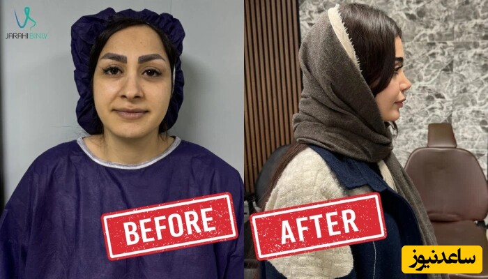 تکنیک‌های نوین در جراحی بینی