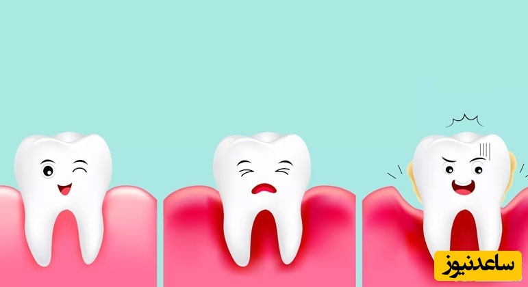 با عوامل به وجود آورنده بیماری لثه آشنا شوید!