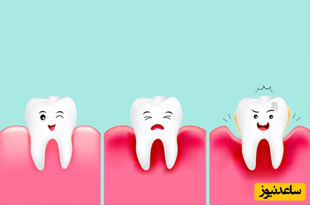 دلایل عفونت و آبسه دندان در کودکان