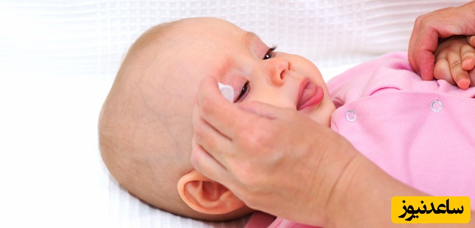 بیماری چشم صورتی