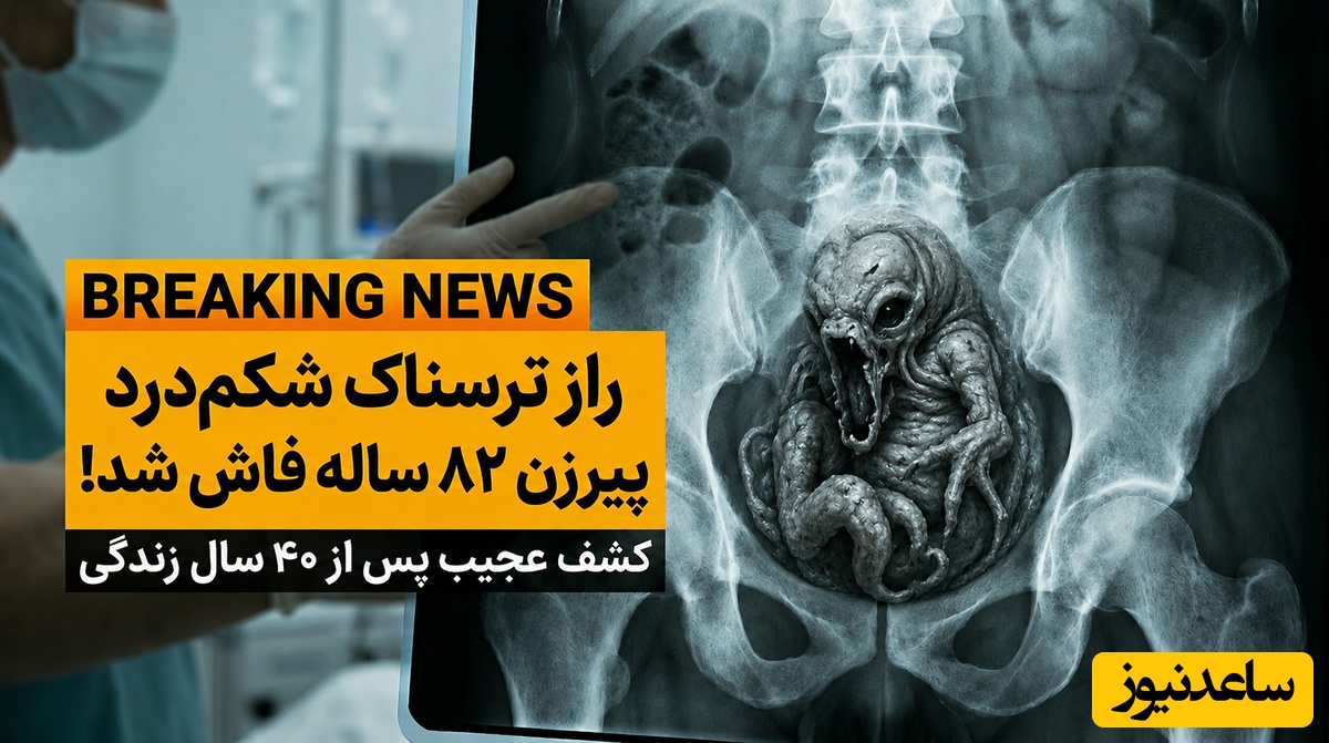 از شکم درد ساده تا کشف نادرترین پدیده جهان؛ راز موجودی که 40 سال در بدن یک زن زندگی می‌کرد + عکس اسکن