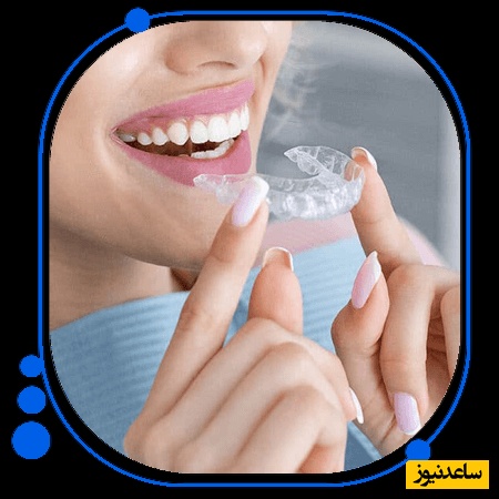 انواع روش‌های ارتودنسی نامرئی چیست؟