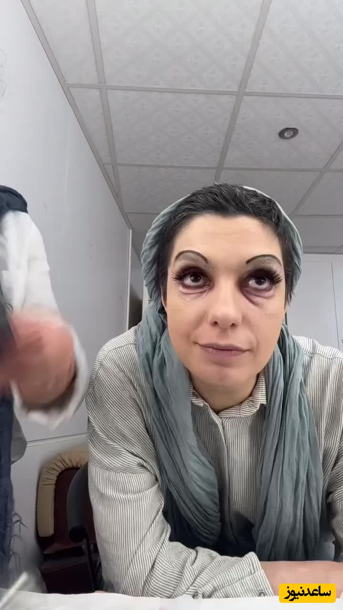 الیکا عبدالرزاقی تغییر چهره داد ؛ خانم بازیگر قابل شناسایی نیست