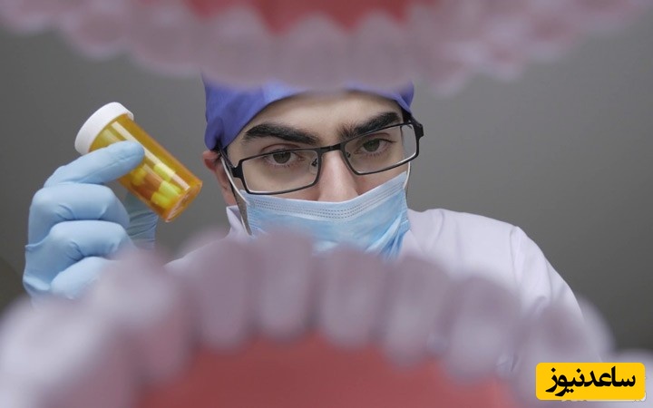 مزایای لمینت های سرامیکی