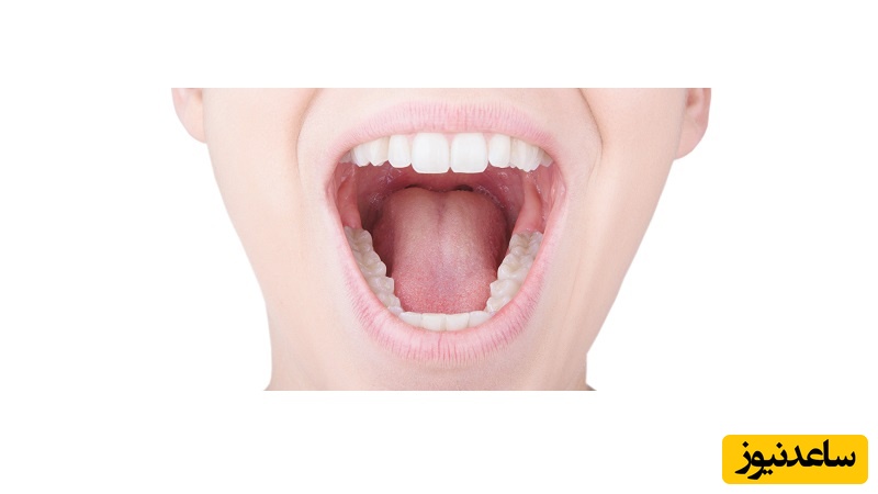 التهاب دهان چیست؟