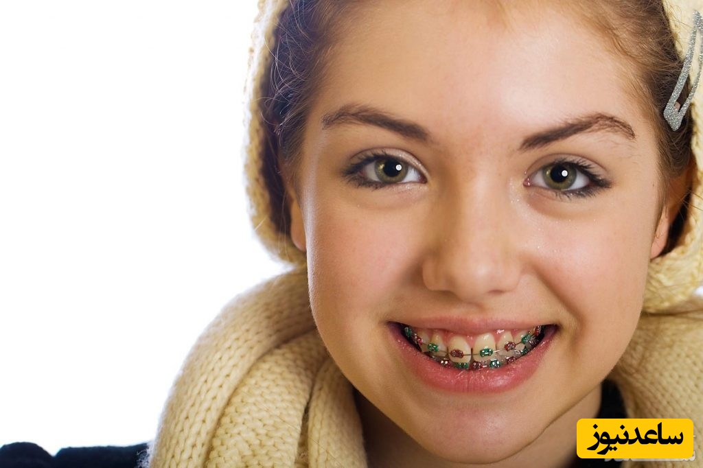 بهترین سن اورتودنسی چه زمانی است؟