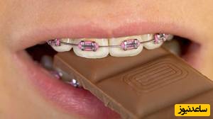 درد ارتودنسی به چه عواملی بستگی دارد؟