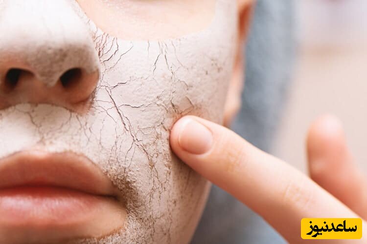 ماسک خاک رس بر ای سلامتی و مراقبت از پوست 
