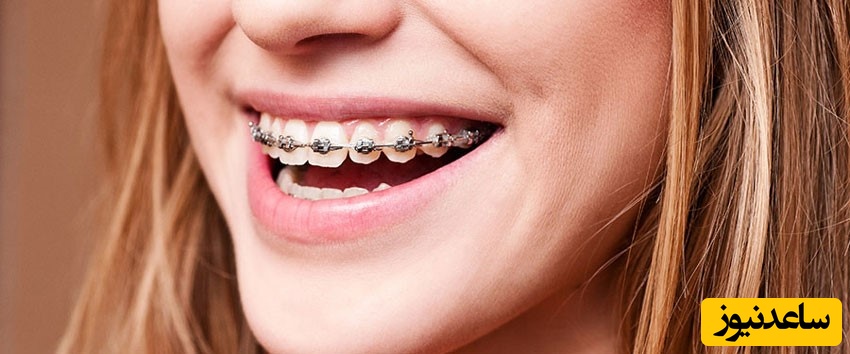 چه شباهت‌ها و تفاوت‌هایی بین ارتودنسی زیبائی و ارتودنسی سنتی وجود دارد؟