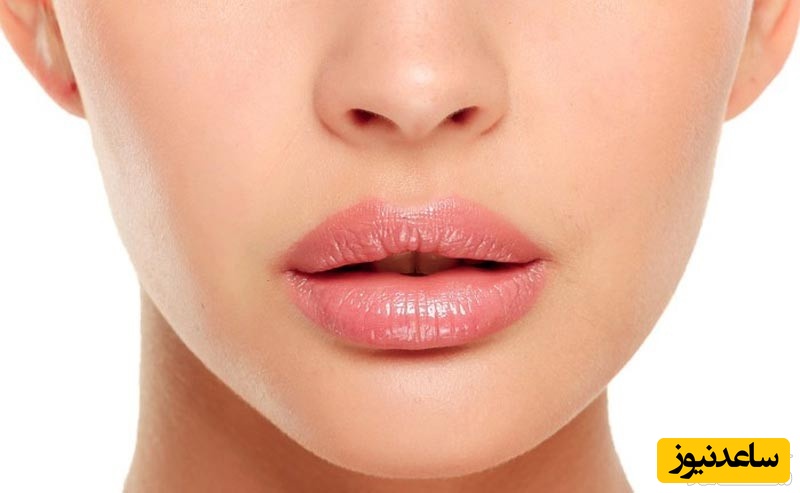 علل ترک گوشه لب چیست؟