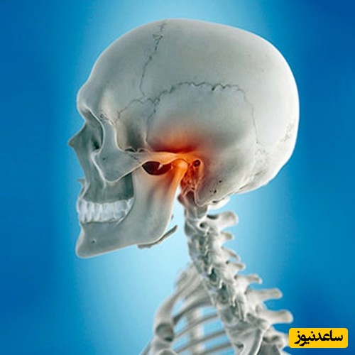 چگونه از درد فک جلوگیری کنیم؟