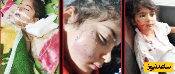 گوشت کودکانمان به دهان سگ‌های ولگرد حسابی مزه کرده!